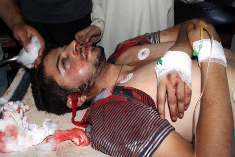 Dozens injured in south Kashmir clashes; Kakapora youth critical