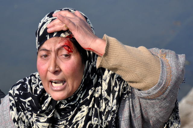 Woman injured critically in Seer Hamdan referred to Srinagar