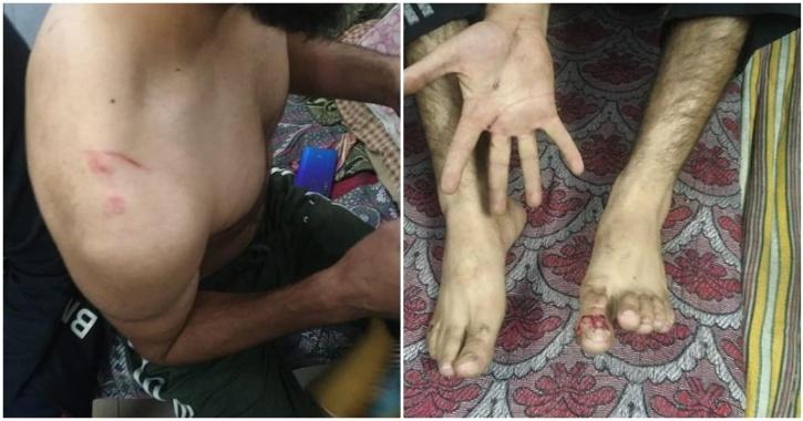 Kashmiri Students Allegedly Beaten in Punjab Colleges After India-Pakistan Match