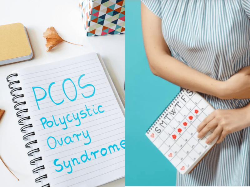 Worrisome as Polycystic Ovary Syndrome (PCOS) Among Kashmiri Women Above 30%, A Global High.